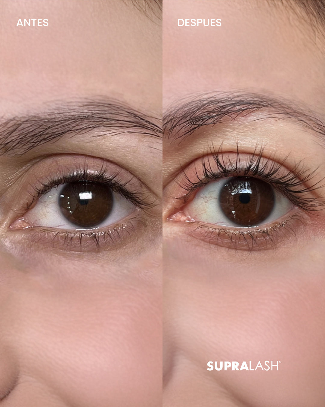 SERUM DE CRECIMIENTO SUPRALASH 2.9 ML